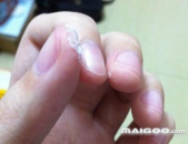 小姐姐胶水粘住脚趾头,小姐姐的惊险经历